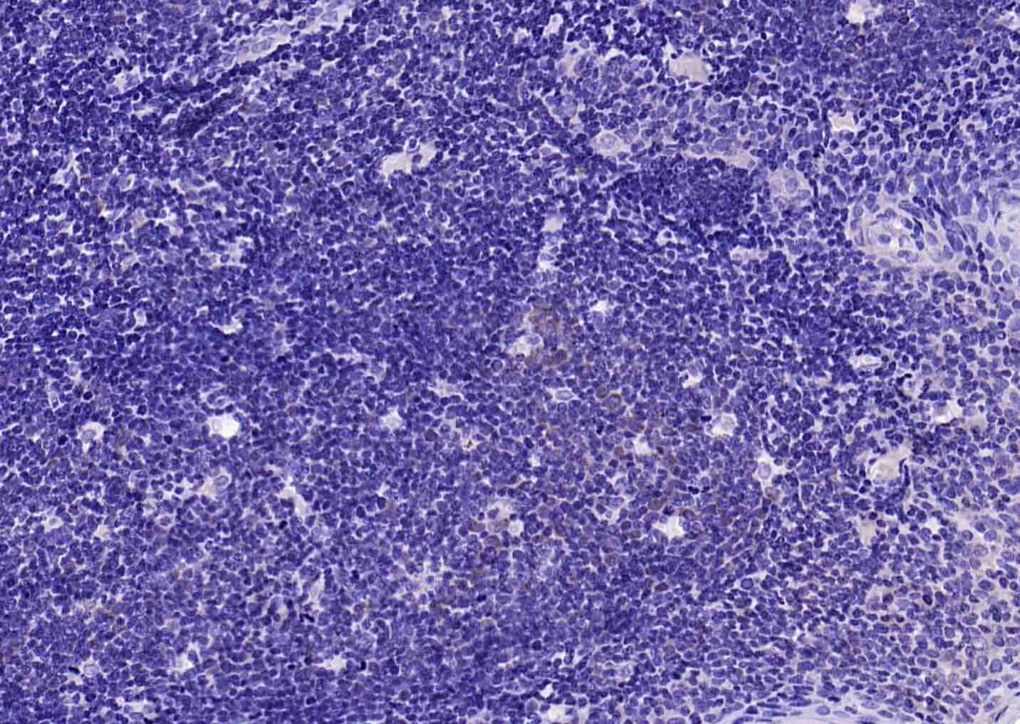 Rabbit anti-TNFR1 Polyclonal Antibody