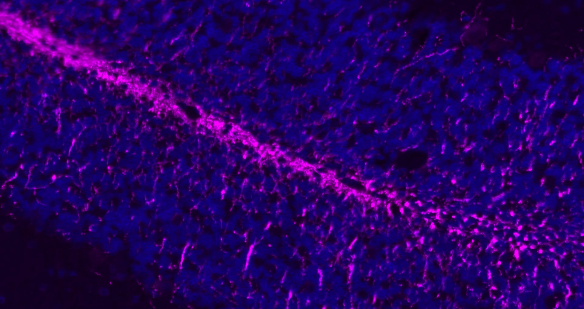 Rabbit anti-MBP Polyclonal Antibody