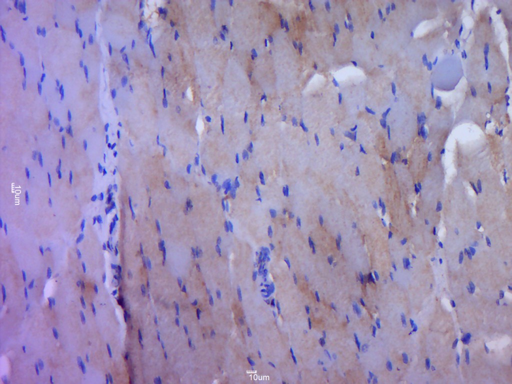 Rabbit anti-Phospho-EGFR(Tyr1068) Polyclonal Antibody