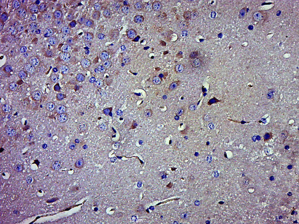 Mouse anti-SGK1 Monoclonal Antibody