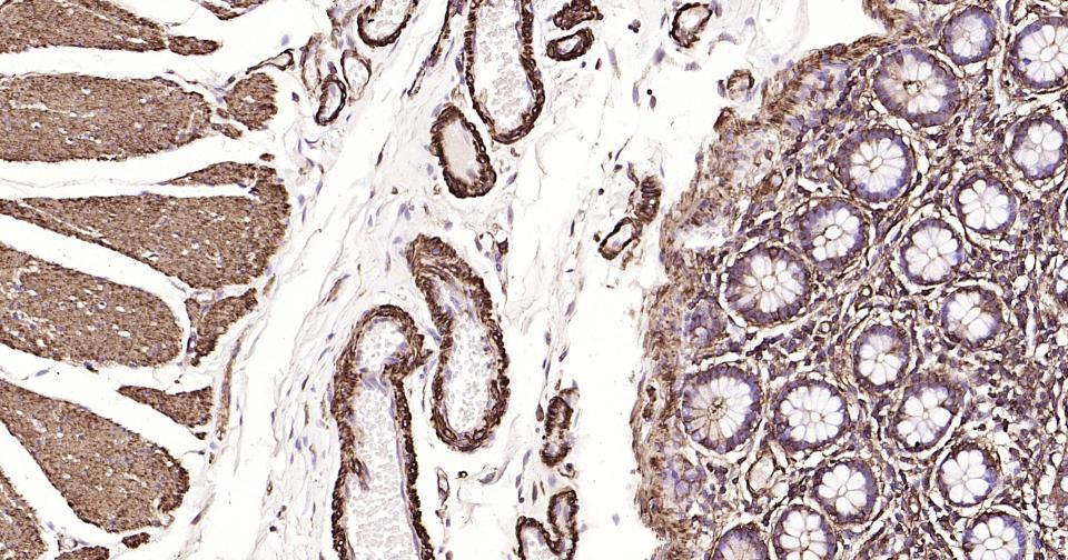 Rabbit anti-α Smooth Muscle Actin Monoclonal Antibody