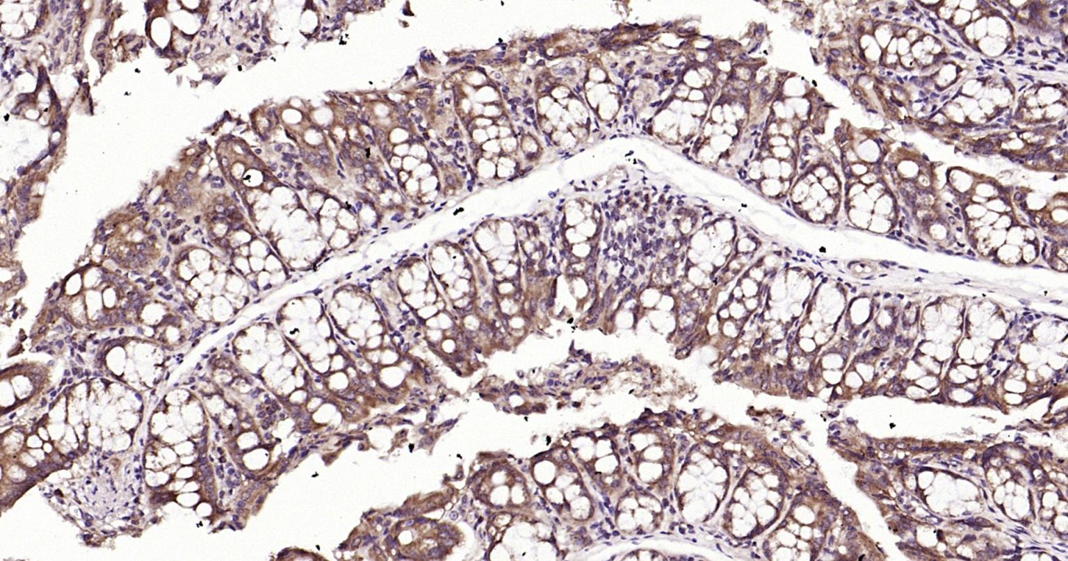 Rabbit anti-Beclin 1 Polyclonal Antibody