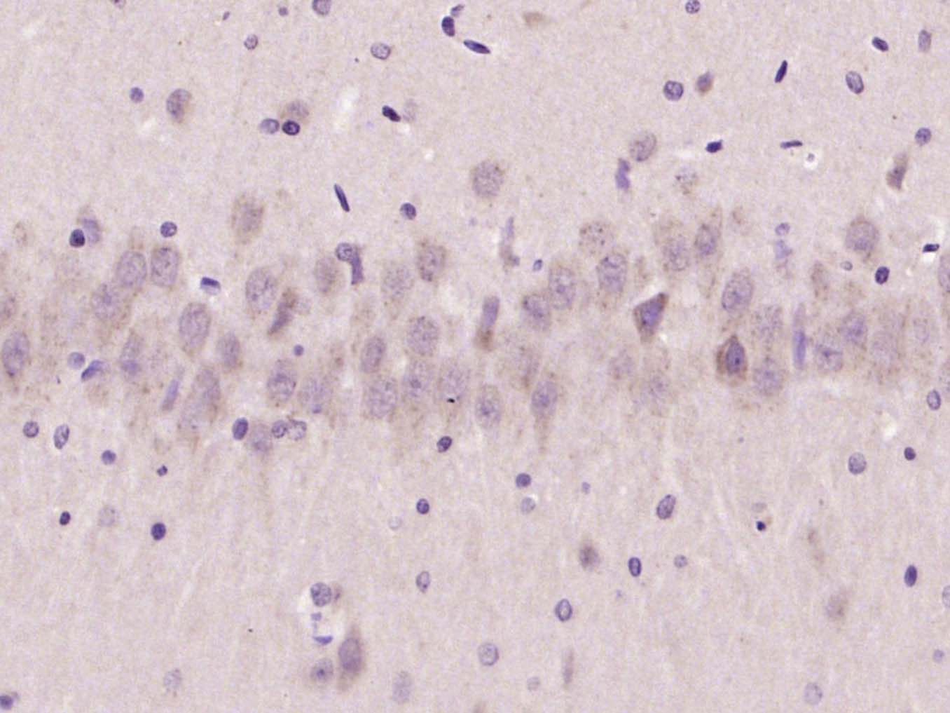 Rabbit anti-PMCA3 Polyclonal Antibody
