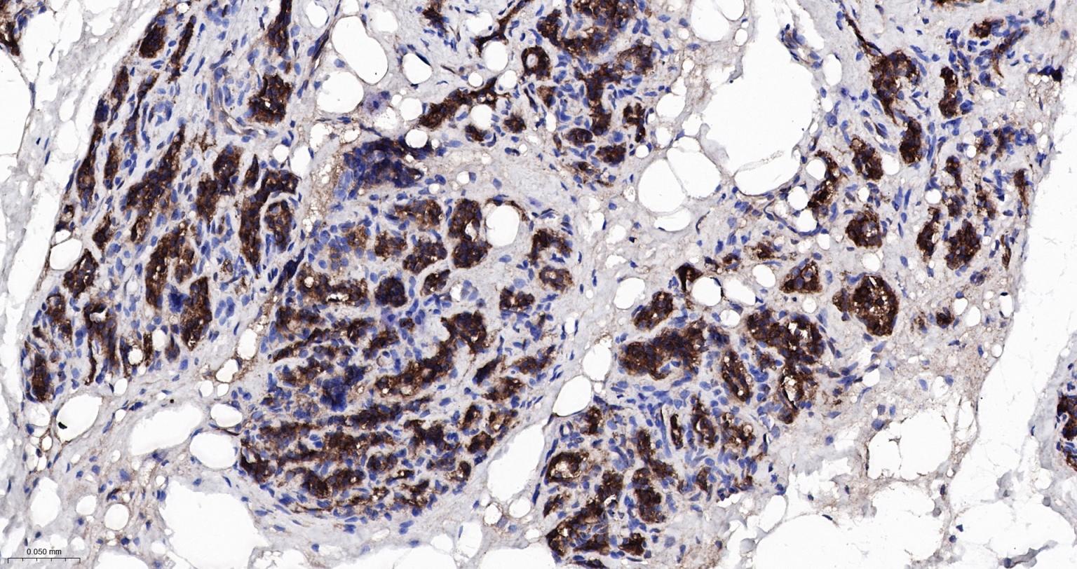 Rabbit anti-NFKB p65 Monoclonal Antibody