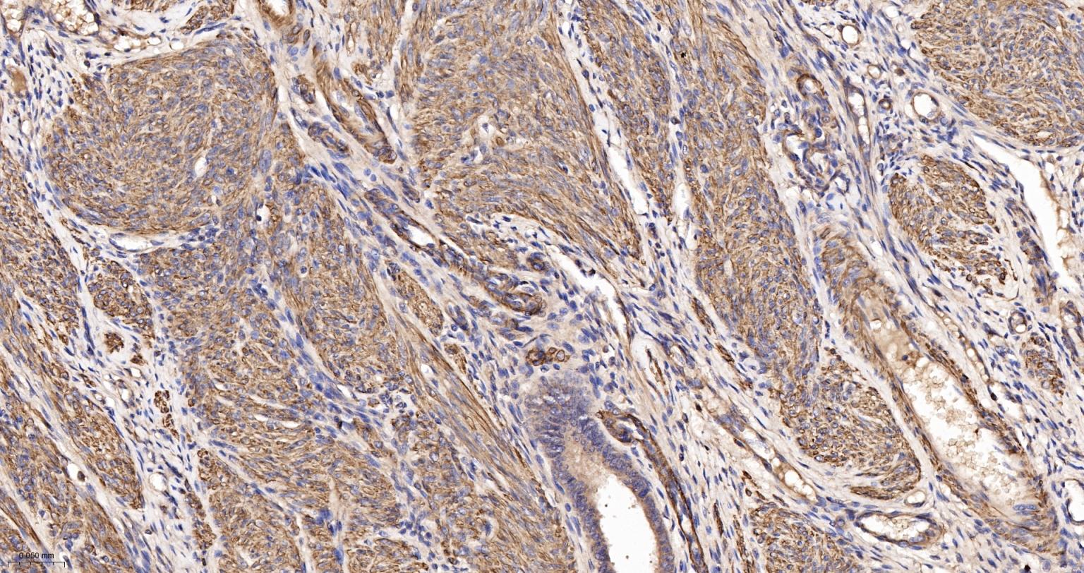 Rabbit anti-α Smooth Muscle Actin Polyclonal Antibody