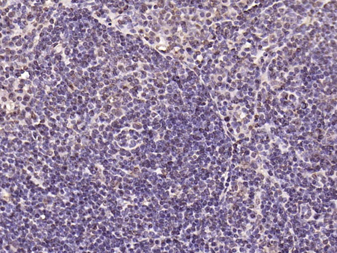 Rabbit anti-Phospho-IKBα(Tyr305) Polyclonal Antibody