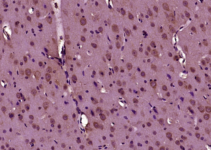 Rabbit anti-Phospho-Doublecortin(Ser128) Polyclonal Antibody