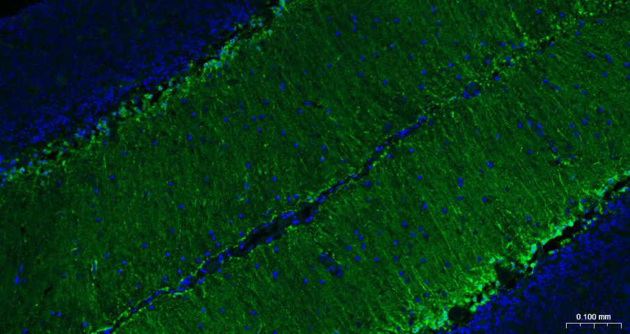 Mouse anti-S100B Monoclonal Antibody