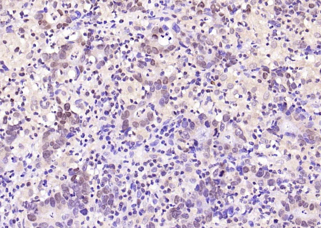 Rabbit anti-Ubiquitin Polyclonal Antibody