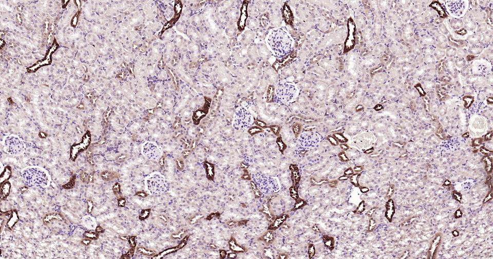 Rabbit anti-Galectin 3 Polyclonal Antibody