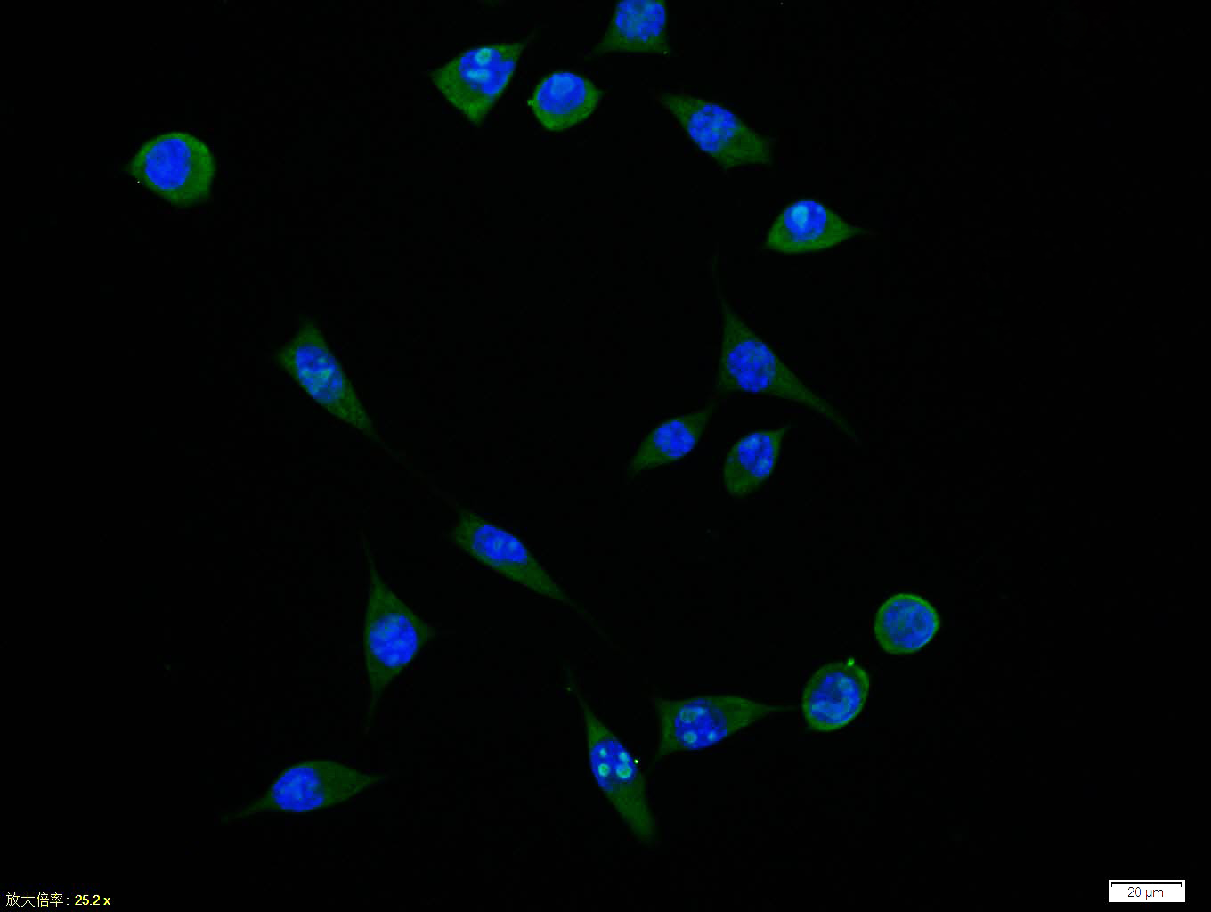 Rabbit anti-Phospho-PDGFRA(Tyr849) /PDGFRB(Tyr857) Polyclonal Antibody