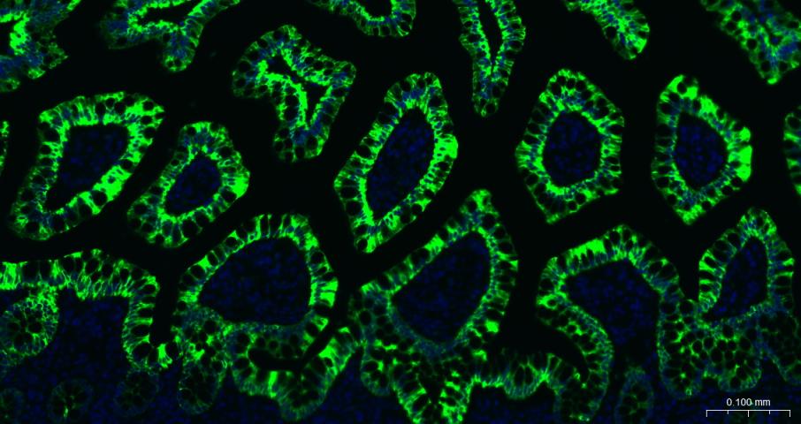 Rabbit anti-CK20 Monoclonal Antibody