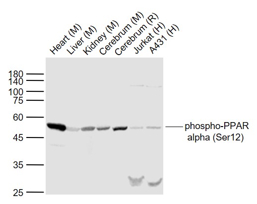 Rabbit anti-Phospho-PPARα(Ser12) Polyclonal Antibody