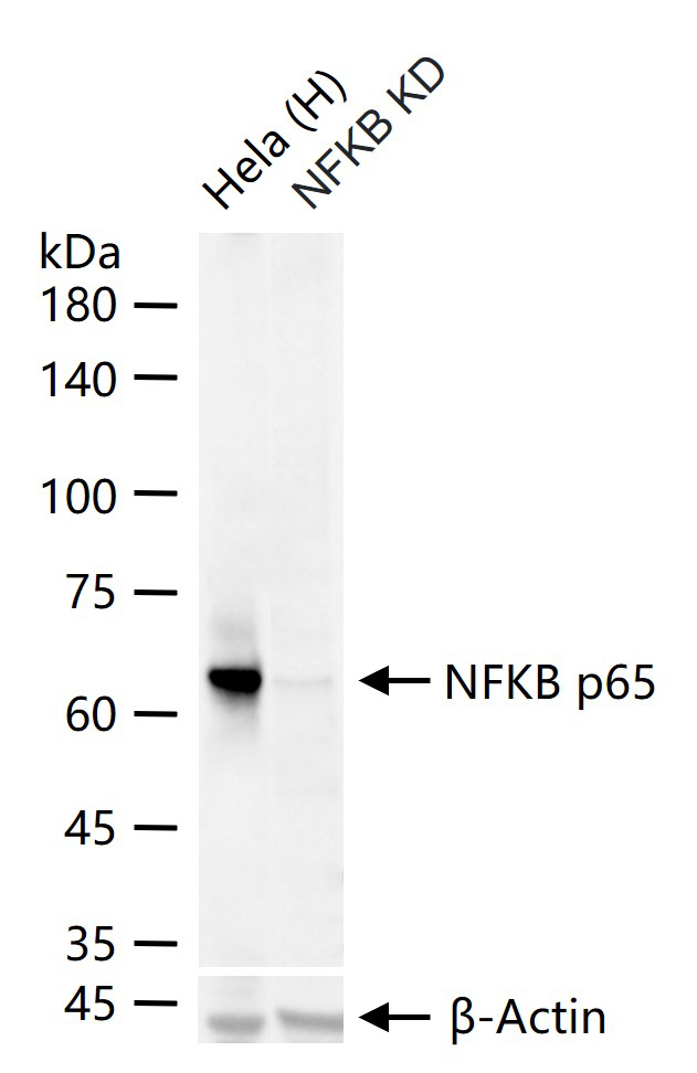 Rabbit anti-NFKB p65 Monoclonal Antibody