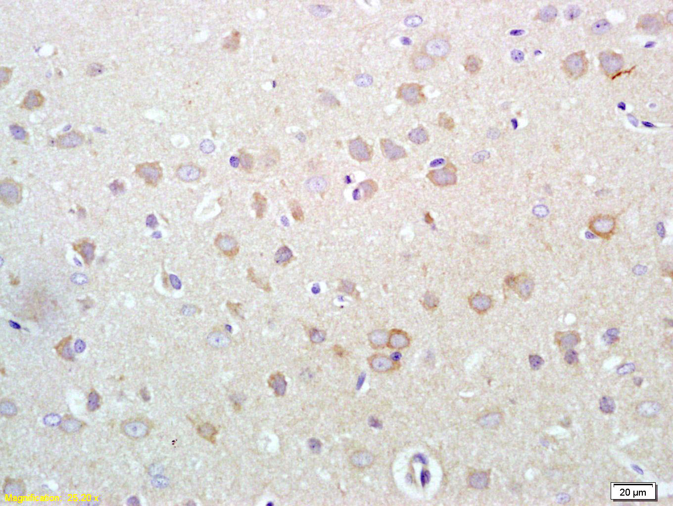 Rabbit anti-Phospho-ERBB3(Tyr1289) Polyclonal Antibody
