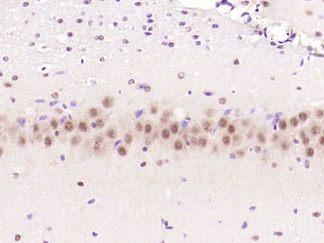 Rabbit anti-Phospho-mTOR(Ser2448) Polyclonal Antibody