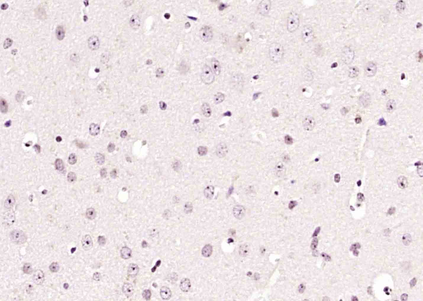 Rabbit Anti-PP1A/PP2CA/PPP1CA Polyclonal Antibody
