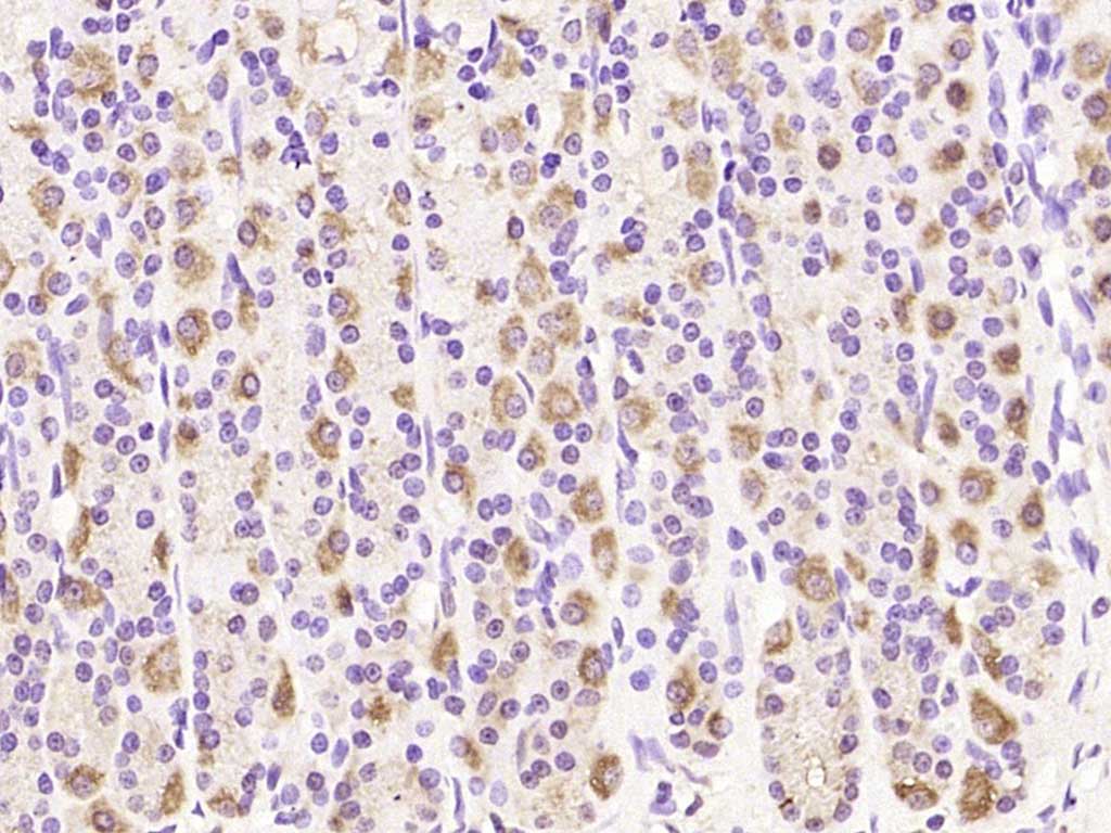 Rabbit anti-MRPL20 Polyclonal Antibody