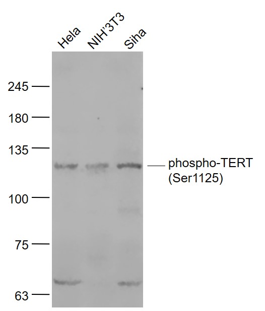 Rabbit anti-Phospho-TERT(Ser1125) Polyclonal Antibody