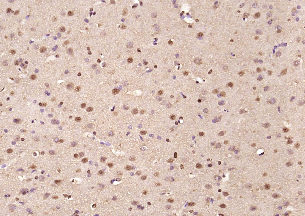 Rabbit anti-Phospho-CTBP1(Ser422) Polyclonal Antibody