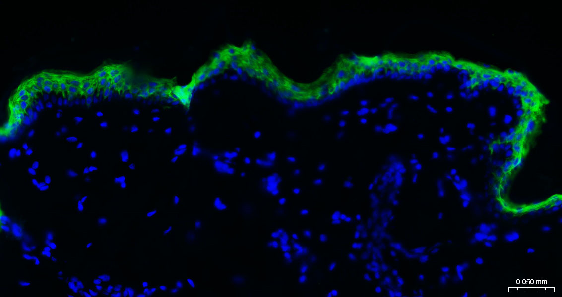 Rabbit anti-CK10/Cytokeratin 10 Monoclonal Antibody