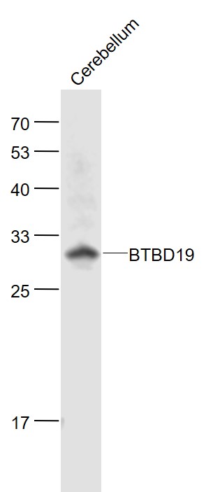 Rabbit anti-BTBD19 Polyclonal Antibody