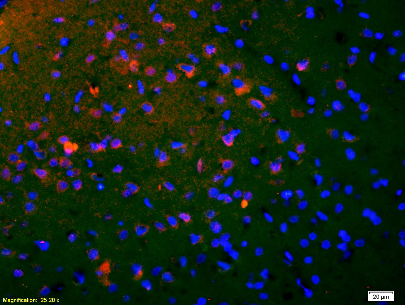 Rabbit anti-Phospho-CREB-1(Ser133) Polyclonal Antibody