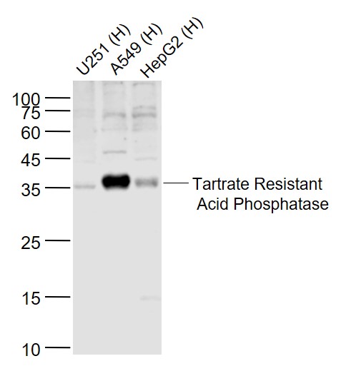 Rabbit anti-Tartrate Resistant Acid Phosphatase Polyclonal Antibody
