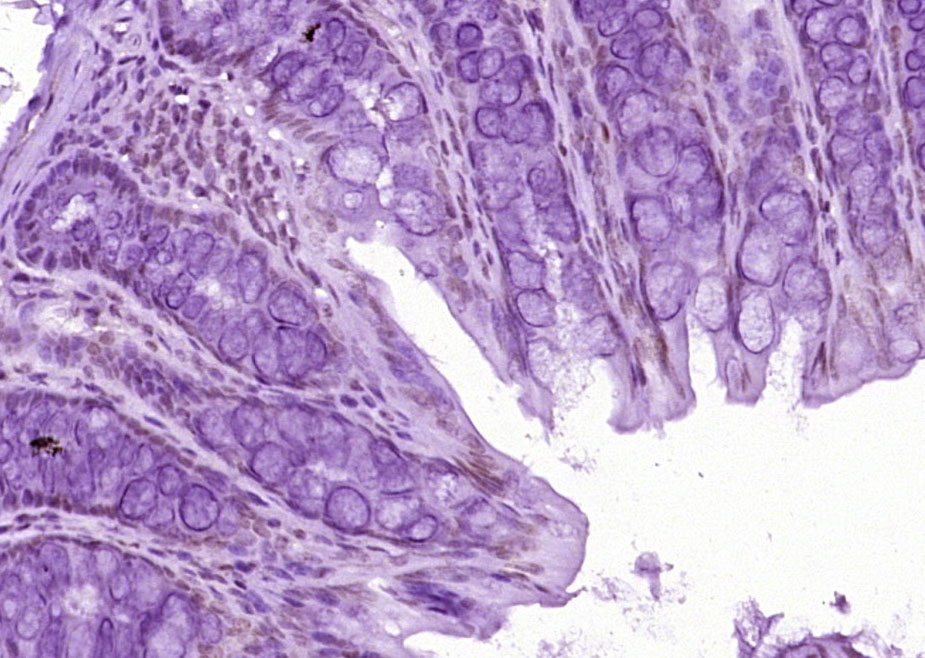 Mouse anti-MonoMethyl-Histone H3(Lys9) Monoclonal Antibody(3F8)