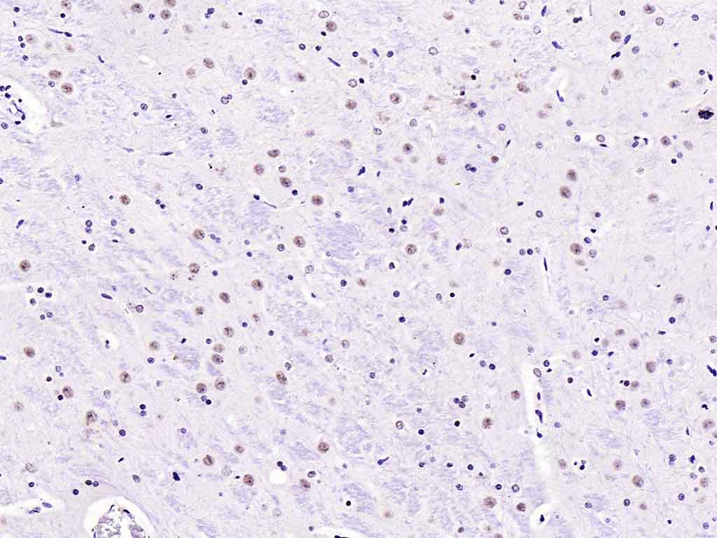 Rabbit anti-Phospho-Smad2(Ser467) Polyclonal Antibody