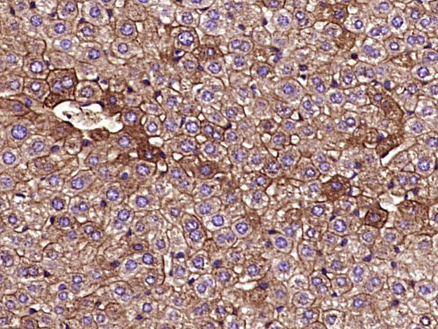 Mouse anti-Cytokeratin 8 Monoclonal Antibody
