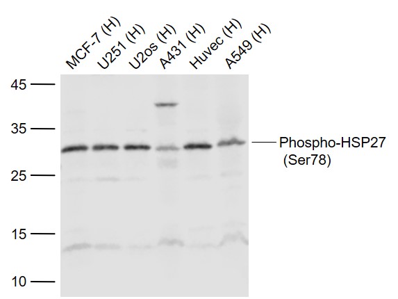 Rabbit anti-Phospho-HSP27(Ser78) Polyclonal Antibody
