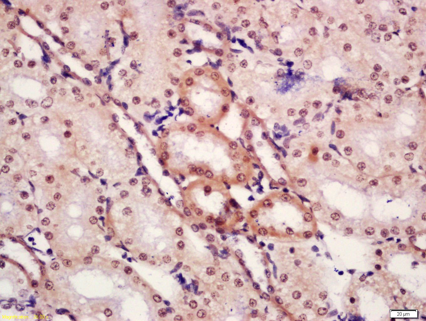 Rabbit anti-Phospho-CTBP1(Ser422) Polyclonal Antibody