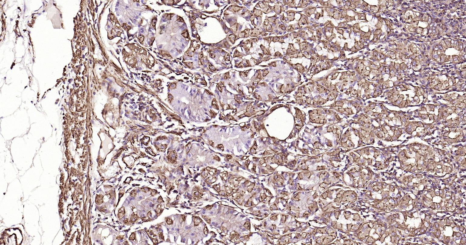 Rabbit anti-α Smooth Muscle Actin Monoclonal Antibody